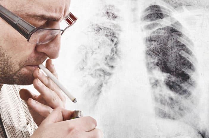 sintomi di cancro ai polmoni