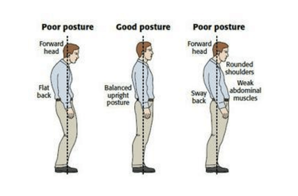 Fonte immagine: http://www.thephysiocompany.com/blog/stop-slouching-postural-dysfunction-symptoms-causes-and-treatment-of-bad-posture