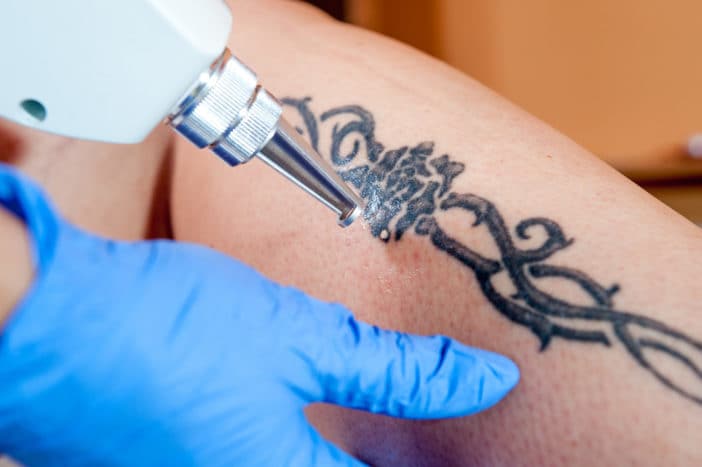 il pericolo dei tatuaggi