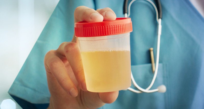 liquido amniotico e urina