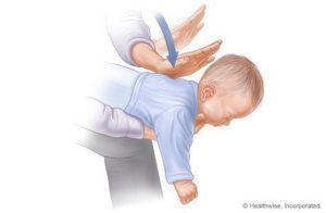 Passi per aiutare a soffocare i neonati (1-3) fonti: www.webmd.com