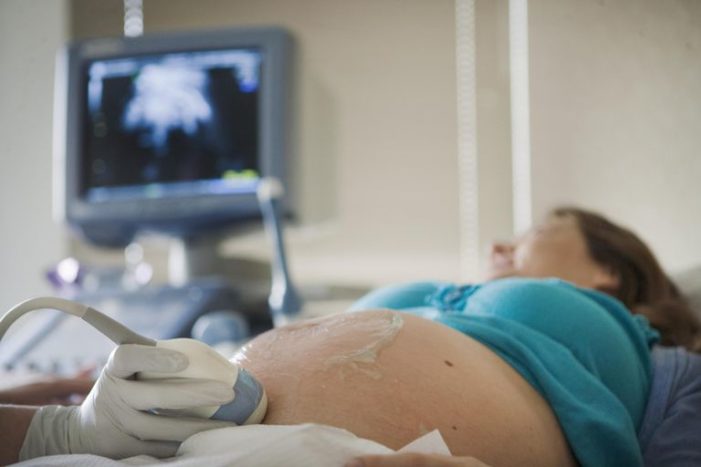 test non test (NST) per donne in stato di gravidanza