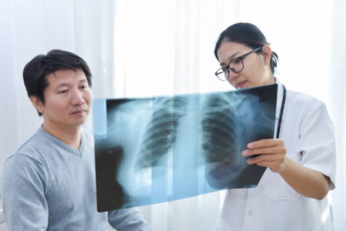 malattia polmonare interstiziale