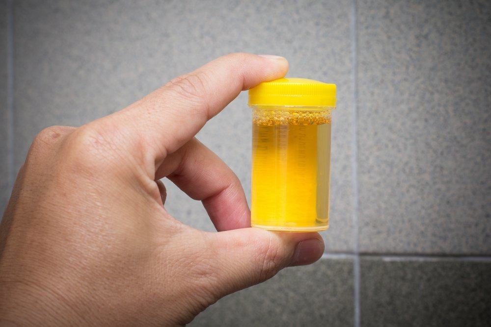terapia urinaria per bere urina