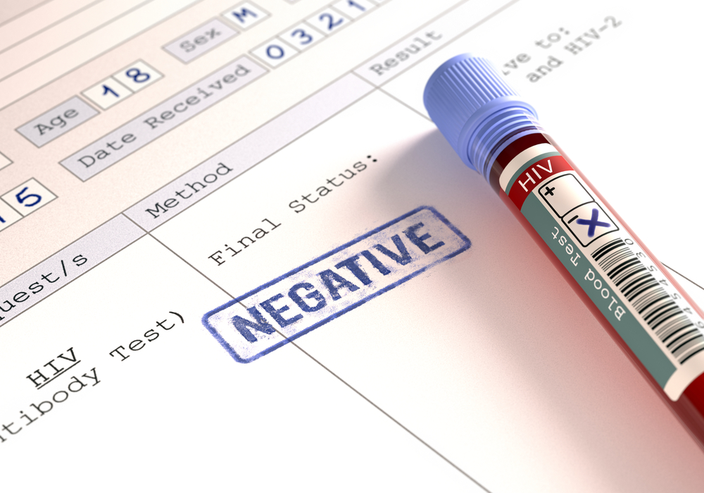 il significato dei risultati di un test HIV negativo