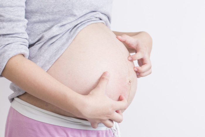 La follicolite pruriginosa è la causa del prurito della pelle durante la gravidanza